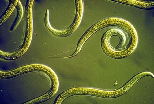 Cacing nematod parasit dalam usus kecil manusia