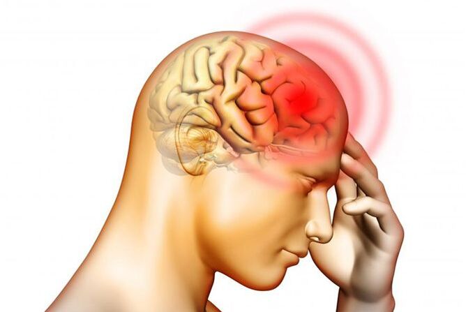 Sakit kepala mungkin merupakan gejala kehadiran larva cacing gelang di telinga tengah